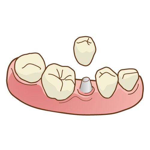 保存治療