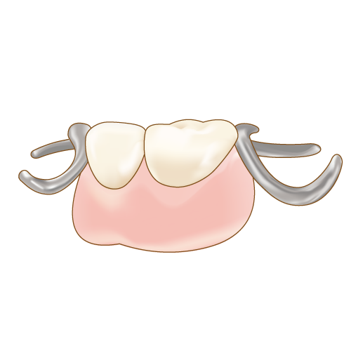 保存治療